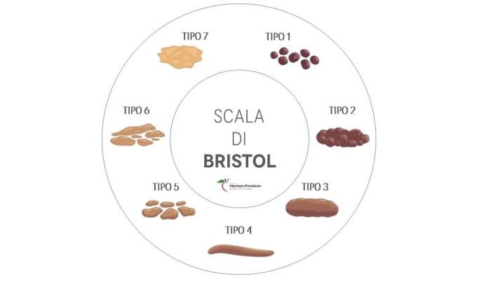 scala di bristol